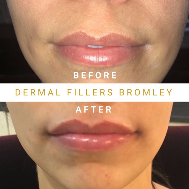 Eason جماليات - Eason Aesthetics