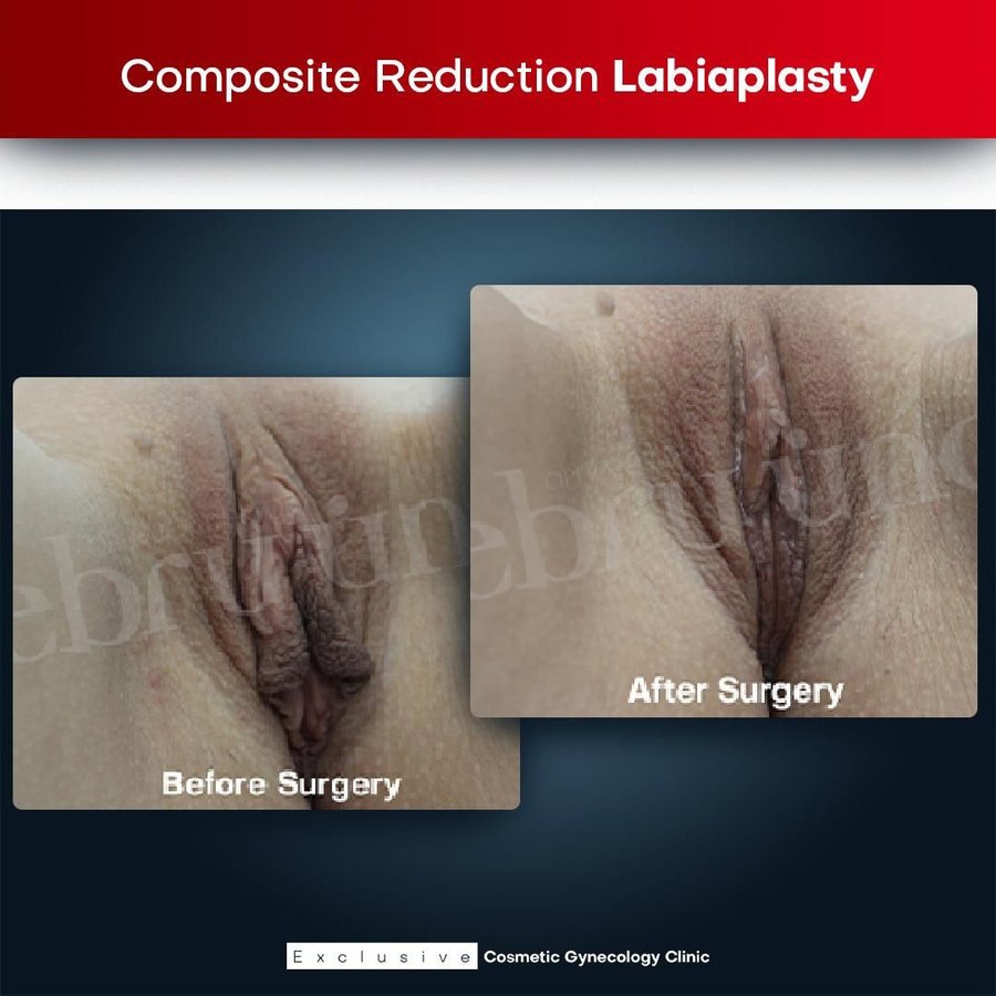 Yalangoch model Karli Kloss