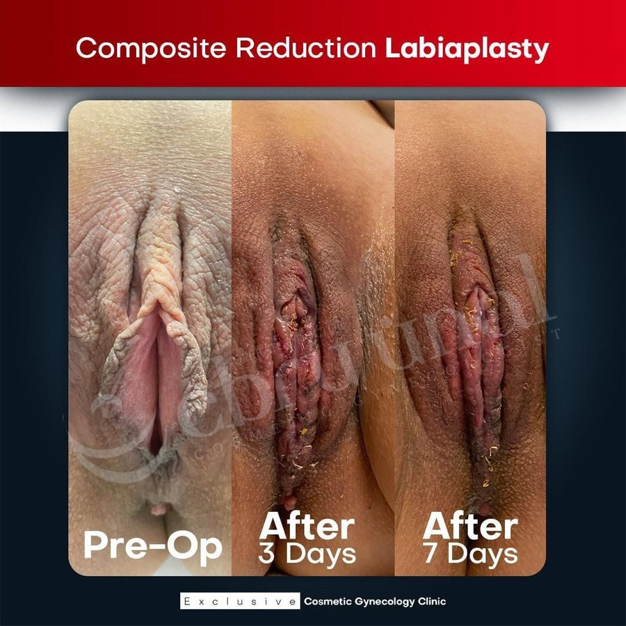 Ebru Unal Cosmetic Gynecology Clinic - Ebru Unal Cosmetic Gynecology Clinic