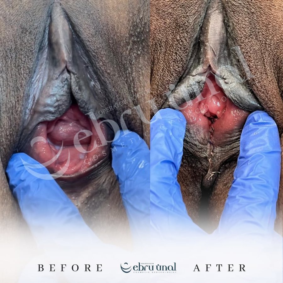 Ebru Unal Cosmetic Gynecology Clinic - Ebru Unal Cosmetic Gynecology Clinic