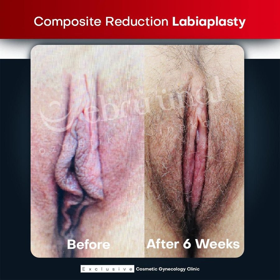 Ebru Unal Cosmetic Gynecology Clinic - Ebru Unal Cosmetic Gynecology Clinic