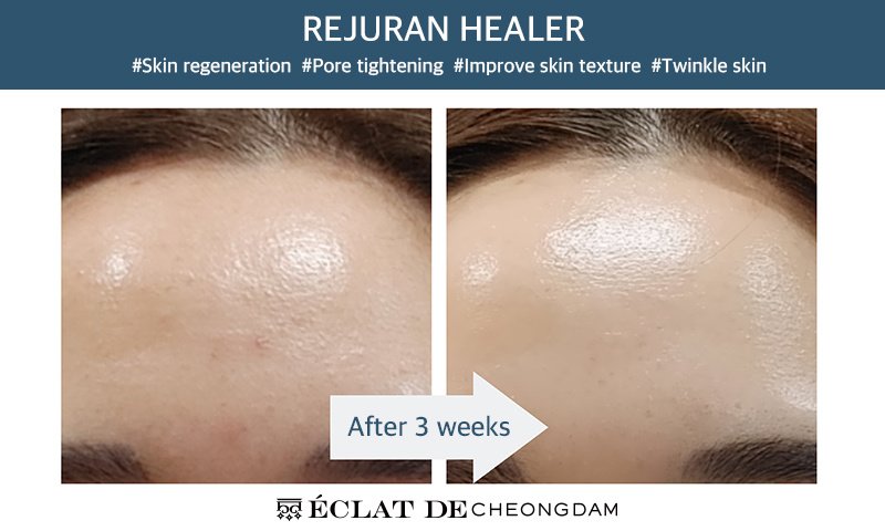 إكلات دي كلينيك - ECLAT DE CLINIC