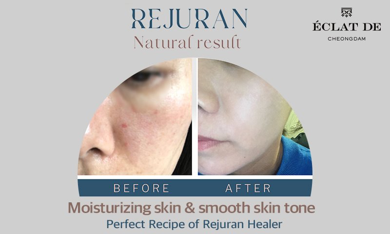 إكلات دي كلينيك - ECLAT DE CLINIC