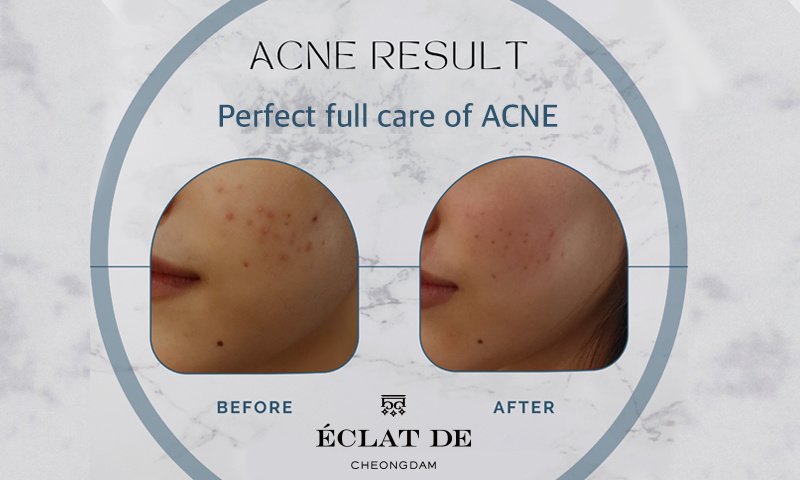 إكلات دي كلينيك - ECLAT DE CLINIC