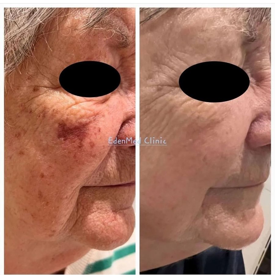 EdenMed Aesthetics and Rejuvenation - EdenMed Aesthetics and Rejuvenation