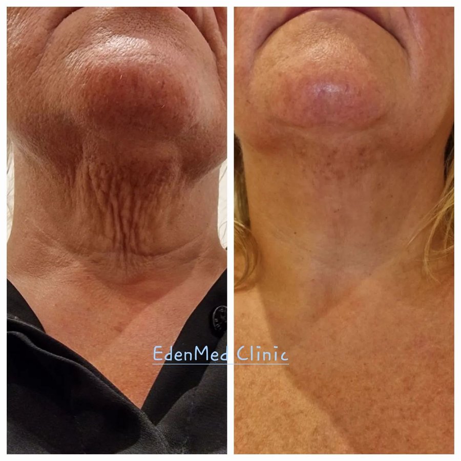 EdenMed Aesthetics and Rejuvenation - EdenMed Aesthetics and Rejuvenation