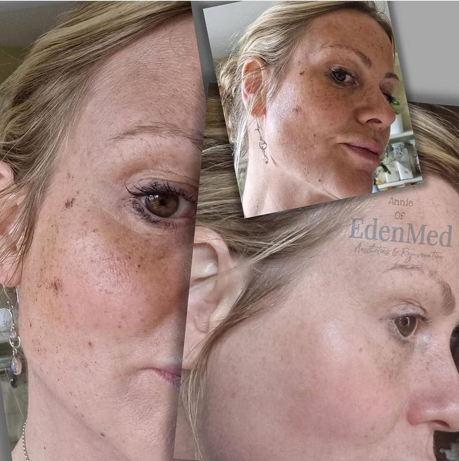 EdenMed Aesthetics and Rejuvenation - EdenMed Aesthetics and Rejuvenation