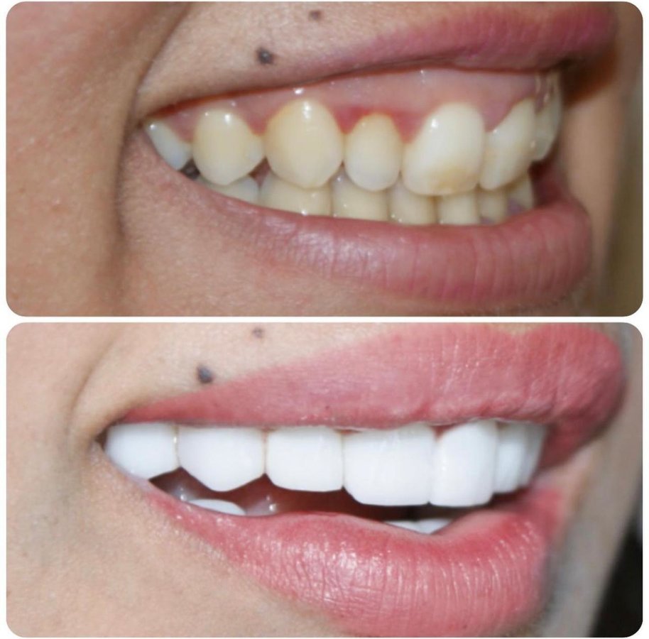 Eksen Dental Clinic - Eksen Dental Clinic