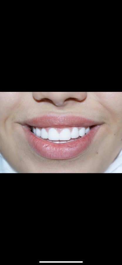 Eksen Dental Clinic - Eksen Dental Clinic