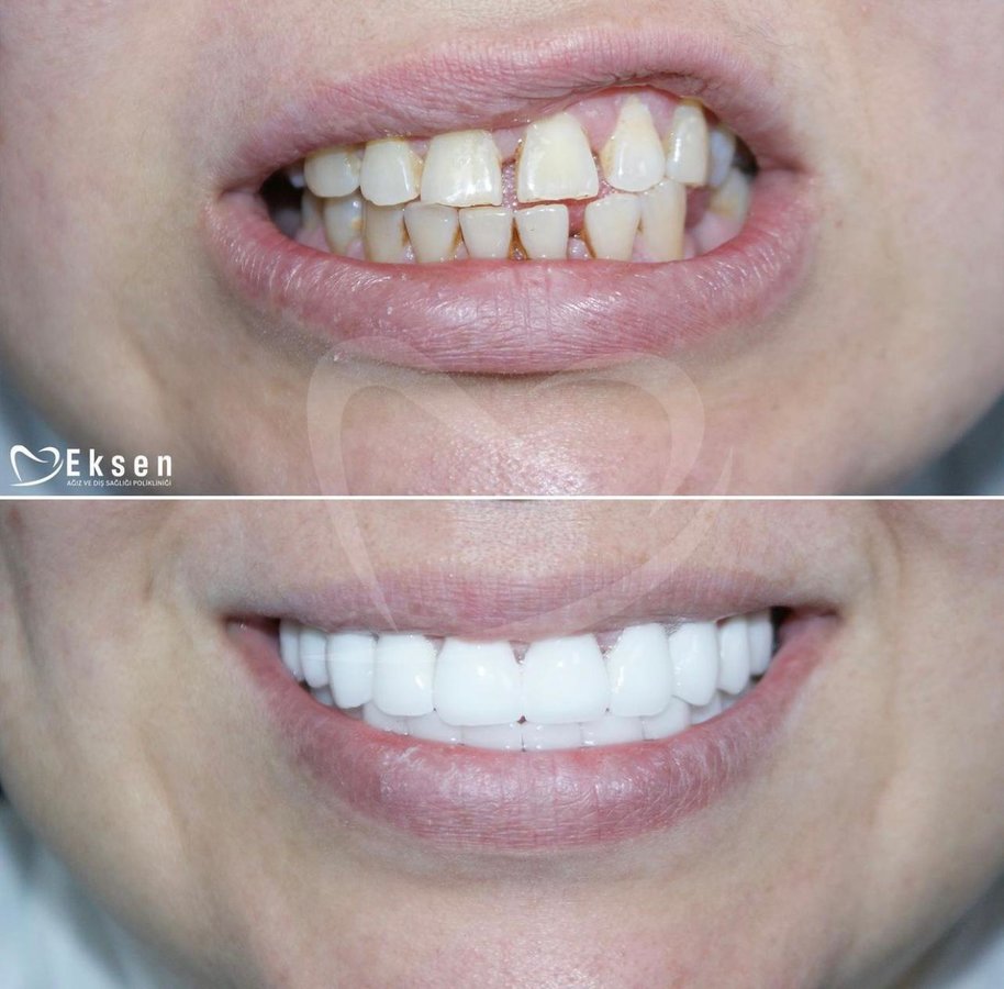 Eksen Dental Clinic - Eksen Dental Clinic