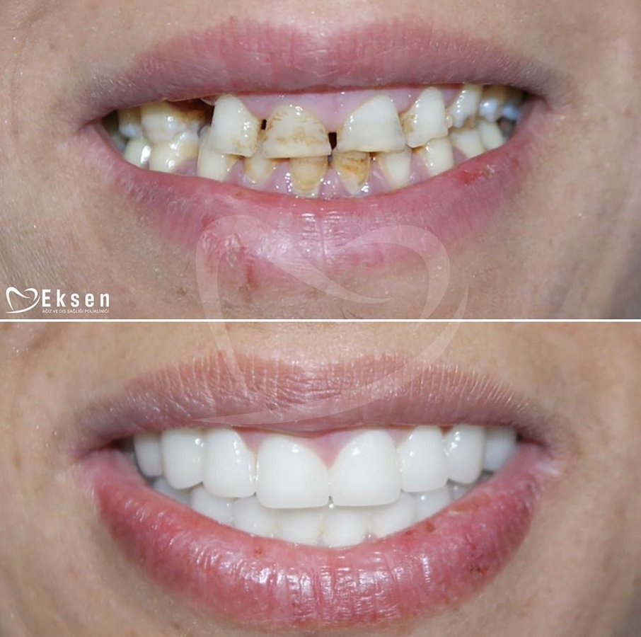 Eksen Dental Clinic - Eksen Dental Clinic