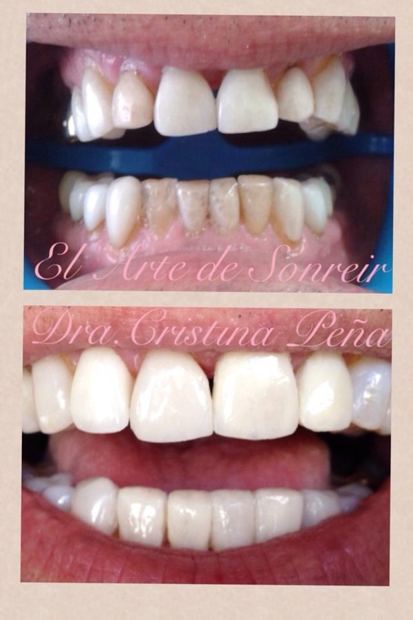 El arte de sonreir/ DENTAL CENTER - El arte de sonreir/ DENTAL CENTER