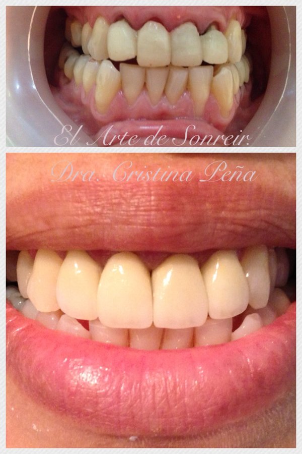 El arte de sonreir/ DENTAL CENTER - El arte de sonreir/ DENTAL CENTER