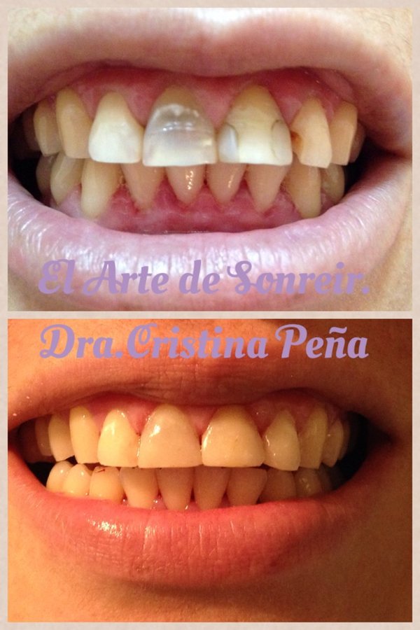 El arte de sonreir/ DENTAL CENTER - El arte de sonreir/ DENTAL CENTER