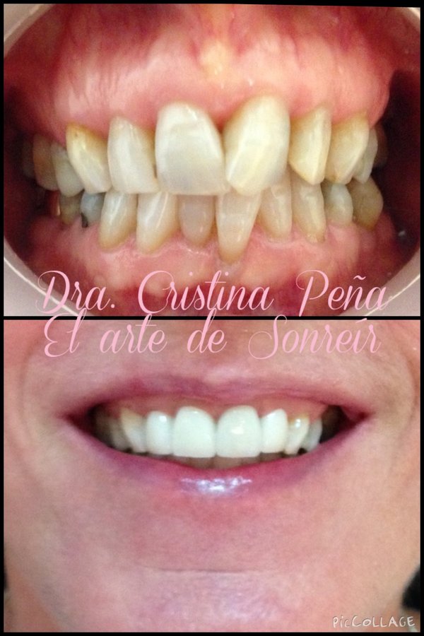 El arte de sonreir/ DENTAL CENTER - El arte de sonreir/ DENTAL CENTER