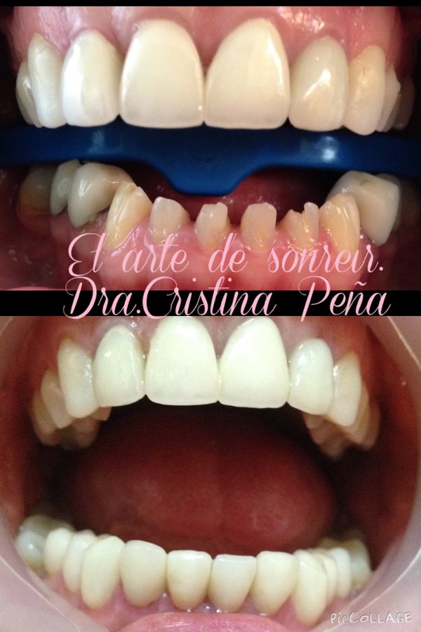 El arte de sonreir/ DENTAL CENTER - El arte de sonreir/ DENTAL CENTER