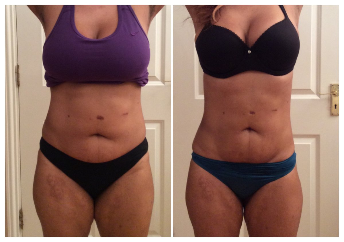 Elite Aesthetics Kent - Elite Aesthetics Kent