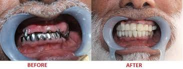 Elite Dental Care - Elite Dental Care