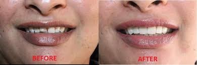 Elite Dental Care - Elite Dental Care