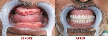 Elite Dental Care - Elite Dental Care