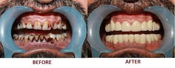 Elite Dental Care - Elite Dental Care