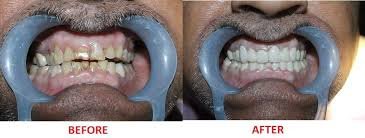 Elite Dental Care - Elite Dental Care