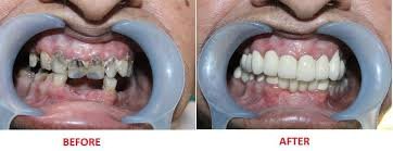 Elite Dental Care - Elite Dental Care