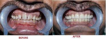 Elite Dental Care - Elite Dental Care