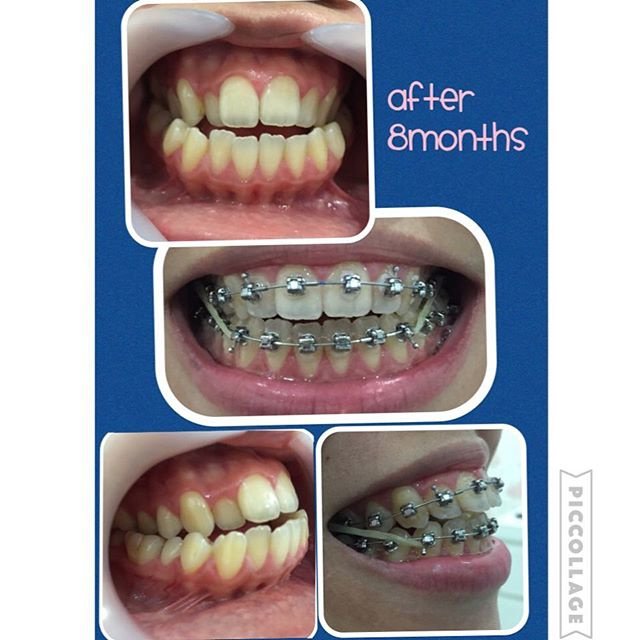 Elite Dental Clinic Jakarta - Elite Dental Clinic Jakarta