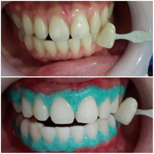 Elite Dental Clinic Jakarta - Elite Dental Clinic Jakarta