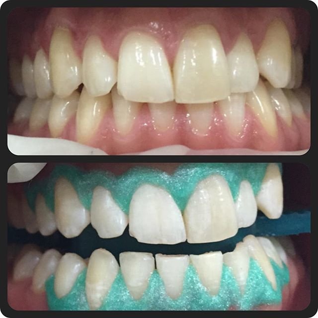 Elite Dental Clinic Jakarta - Elite Dental Clinic Jakarta