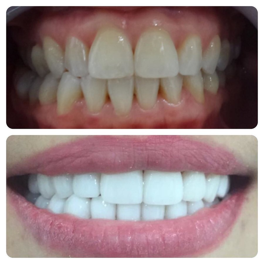 Elite Dental Clinic Jakarta - Elite Dental Clinic Jakarta