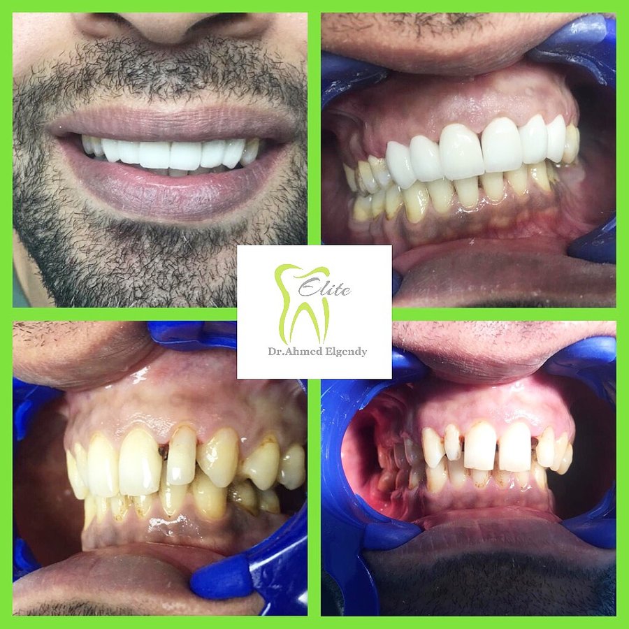 Elite Dèntal dr ahmed el gendy - New Cairo - Elite Dèntal dr ahmed el gendy - New Cairo
