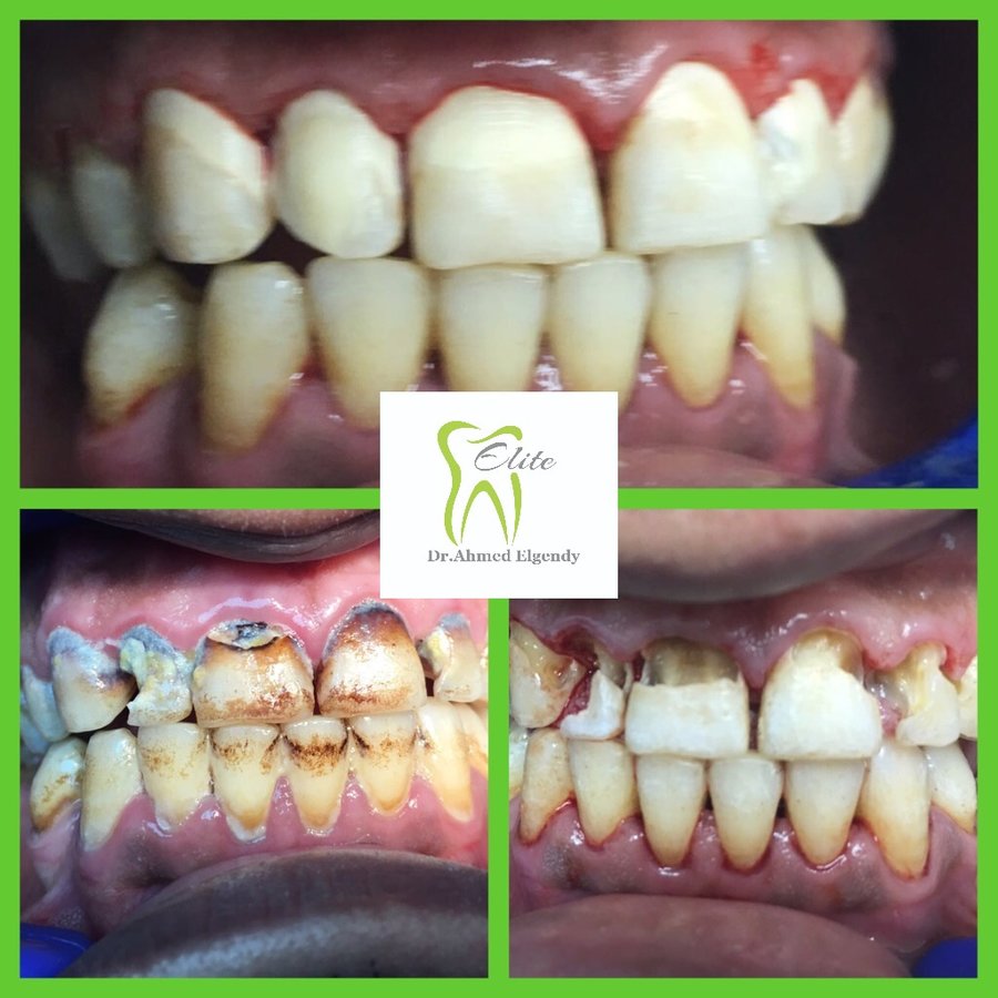 Elite Dèntal dr ahmed el gendy - New Cairo - Elite Dèntal dr ahmed el gendy - New Cairo