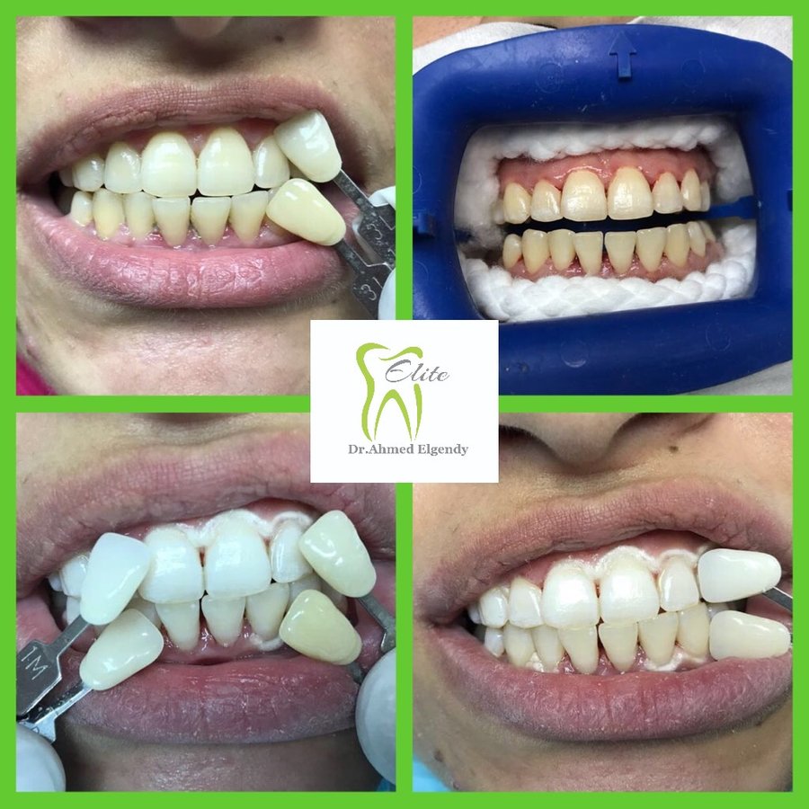 Elite Dèntal dr ahmed el gendy - New Cairo - Elite Dèntal dr ahmed el gendy - New Cairo