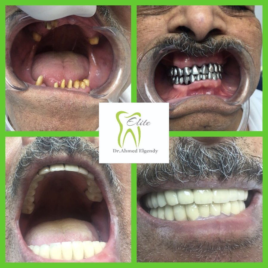 Elite Dèntal dr ahmed el gendy - New Cairo - Elite Dèntal dr ahmed el gendy - New Cairo