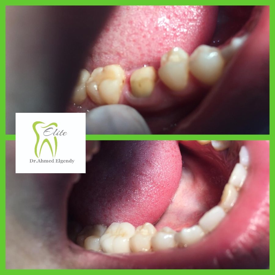 Elite Dèntal dr ahmed el gendy - New Cairo - Elite Dèntal dr ahmed el gendy - New Cairo