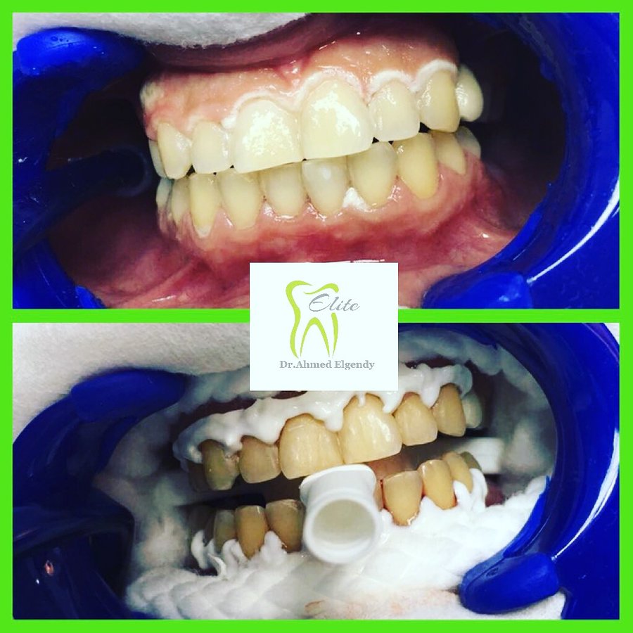 Elite Dèntal dr ahmed el gendy - New Cairo - Elite Dèntal dr ahmed el gendy - New Cairo
