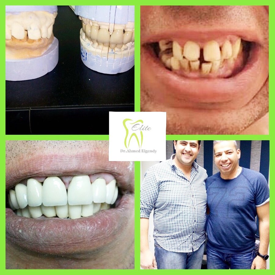 Elite Dèntal dr ahmed el gendy - New Cairo - Elite Dèntal dr ahmed el gendy - New Cairo