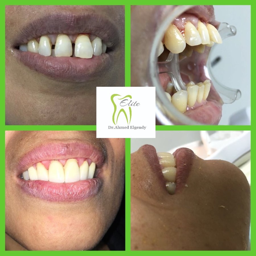 Elite Dèntal dr ahmed el gendy - New Cairo - Elite Dèntal dr ahmed el gendy - New Cairo