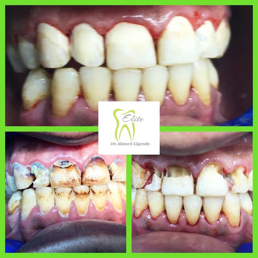 Elite Dèntal dr ahmed el gendy - New Cairo - Elite Dèntal dr ahmed el gendy - New Cairo