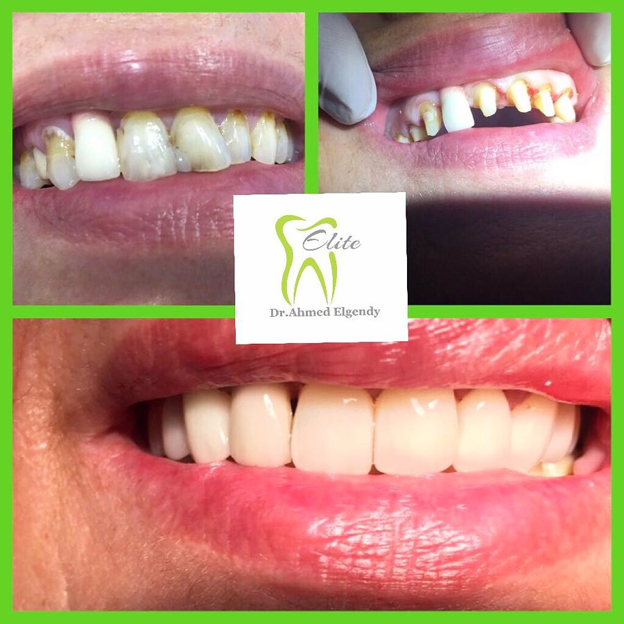 Elite Dèntal dr ahmed el gendy - New Cairo - Elite Dèntal dr ahmed el gendy - New Cairo