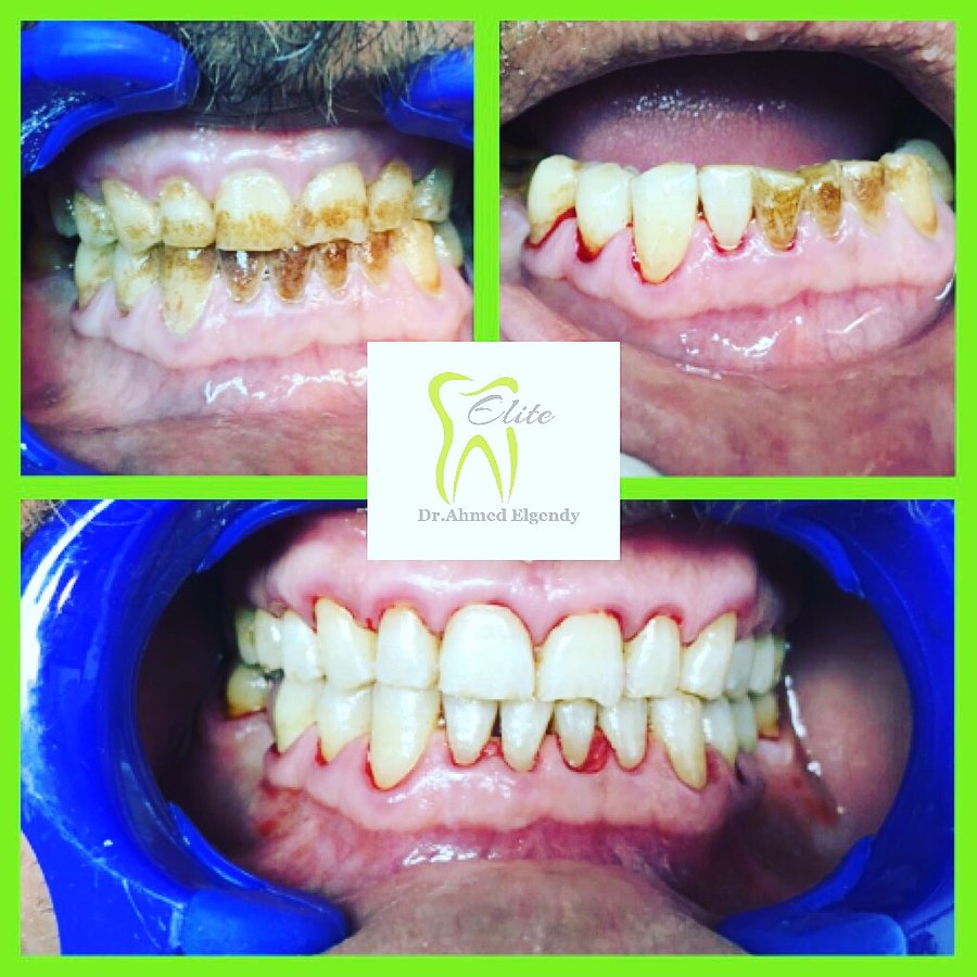 Elite Dèntal dr ahmed el gendy - New Cairo - Elite Dèntal dr ahmed el gendy - New Cairo