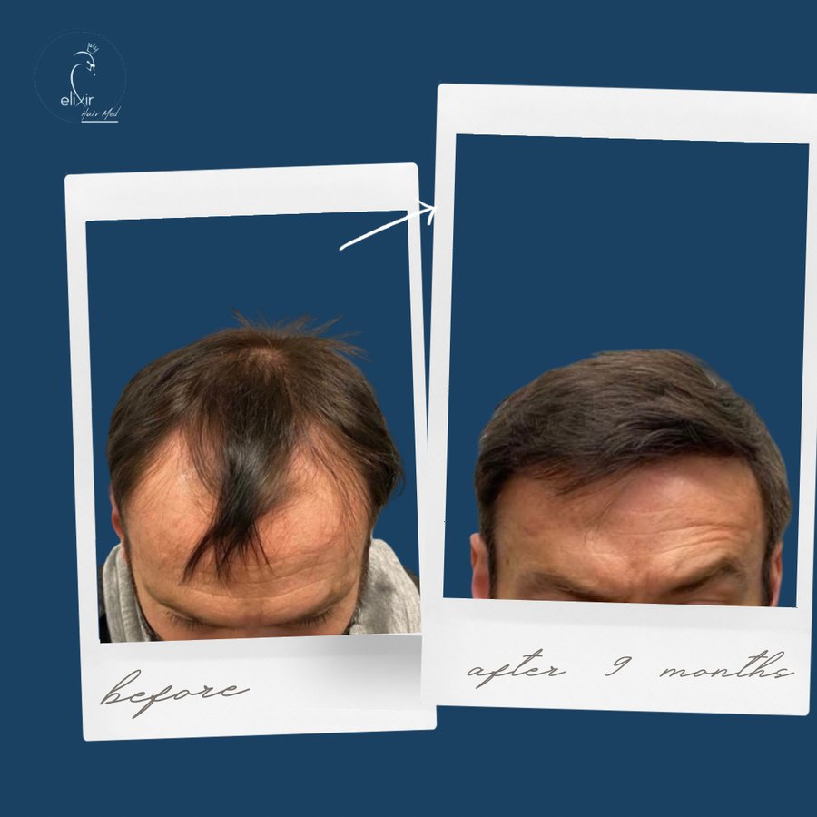 Elixir Hair Med - Elixir Hair Med