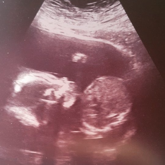 Embryoland Center for Assisted Reproduction and Fertility - Embryoland Center for Assisted Reproduction and Fertility