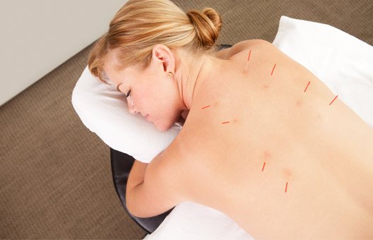 Emma James Physio - Hertfordshire Clinic - Emma James Physio - Hertfordshire Clinic