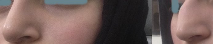 Ent Department Cmh Lahore Cantt - Ent Department Cmh Lahore Cantt