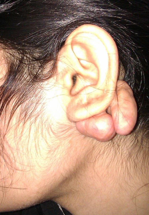 Ent Department Cmh Lahore Cantt - Ent Department Cmh Lahore Cantt