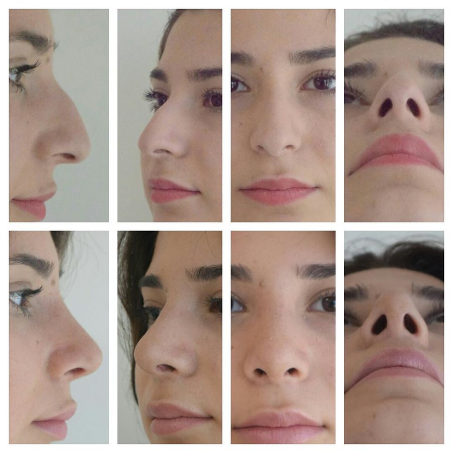 مركز ENTO الطبي عيادة زراعة الشعر - ENTO Medical Center Hair Transplant Clinic