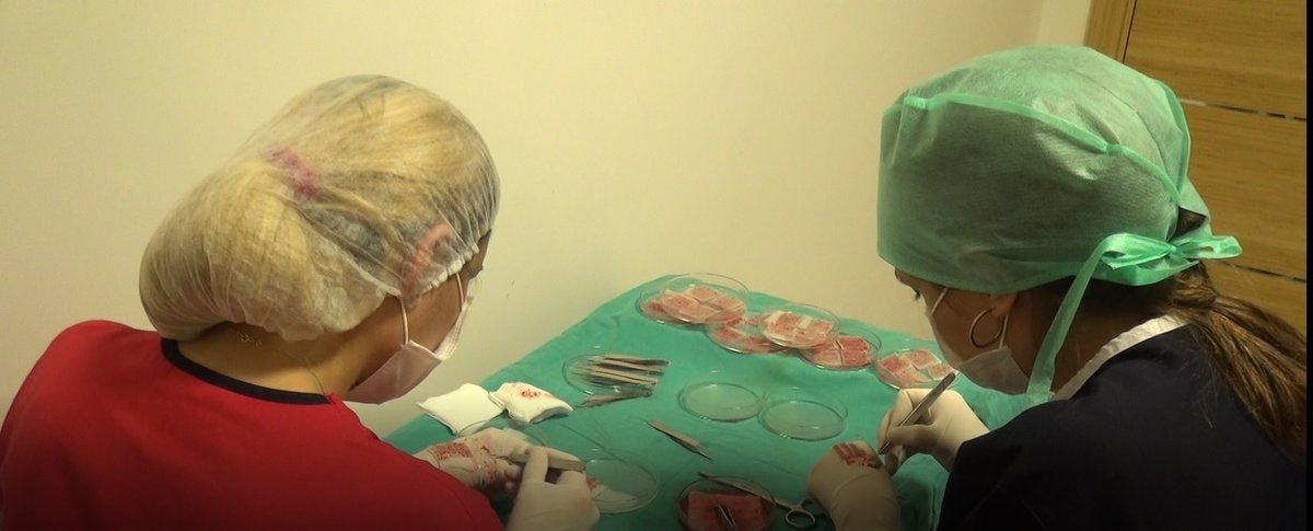 مركز ENTO الطبي عيادة زراعة الشعر - ENTO Medical Center Hair Transplant Clinic